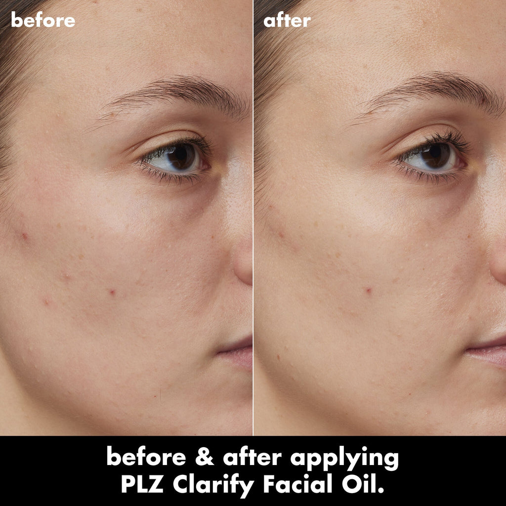 PLZ Clarify Facial Oil
